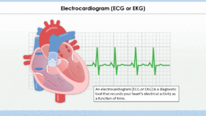 An electrocardiogram ECG EKG is a measure of your heart's electrical activity as a function of time.