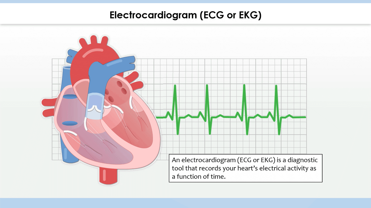 An electrocardiogram ECG EKG is a measure of your heart's electrical activity as a function of time.