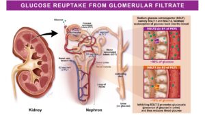 Medical illustration